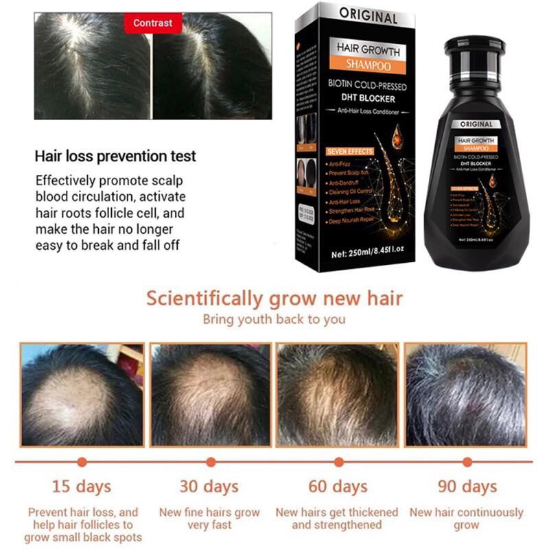 HAIR GROWTH DHT BLOCKER ANTI HAIR LOSS HAIR TREATMENT SHAMPOO 250ML